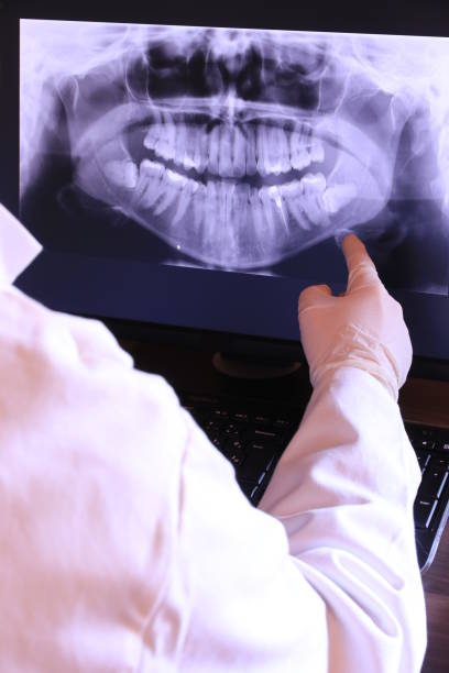 Best Emergency Tooth Extraction in Mcnair, VA